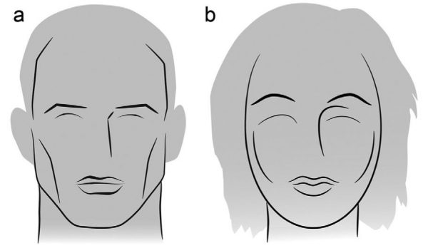 Cirugía de feminización facial_facial feminization surgery