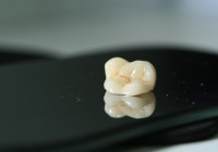Prótesis dentales en Alicante Materiales_Enamic