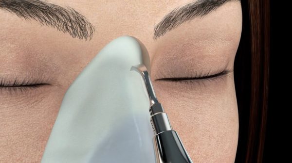 NUEVA RINOPLASTIA ULTRASÓNICA